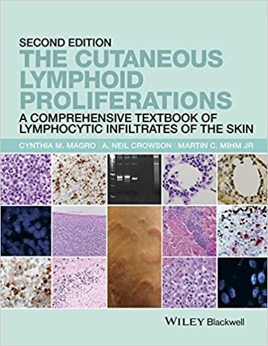 کتاب د کیوتنیس لیمفوئید پرولیفریشنز The Cutaneous Lymphoid Proliferations: A Comprehensive Textbook of Lymphocytic Infiltrates