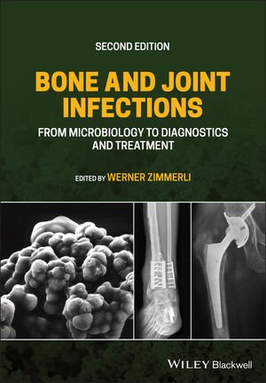 کتاب 2021 Back to results Bone and Joint Infections: From Microbiology to Diagnostics and Treatment 2nd