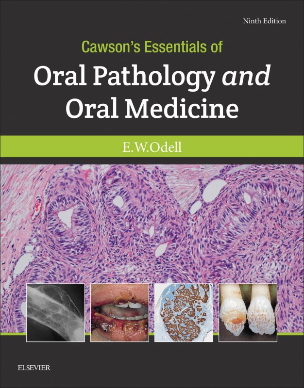 کتاب اورال پاتولوژی اند اورال مدیسین Cawson's Essentials of Oral Pathology and Oral Medicine 2017 9th