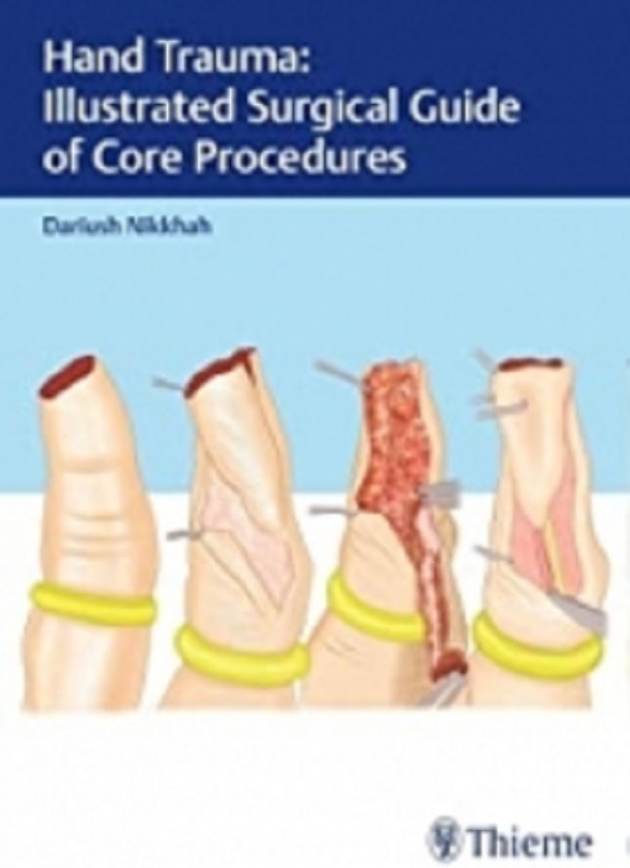 کتاب هند تروما Hand Trauma: Illustrated Surgical Guide of Core Procedures